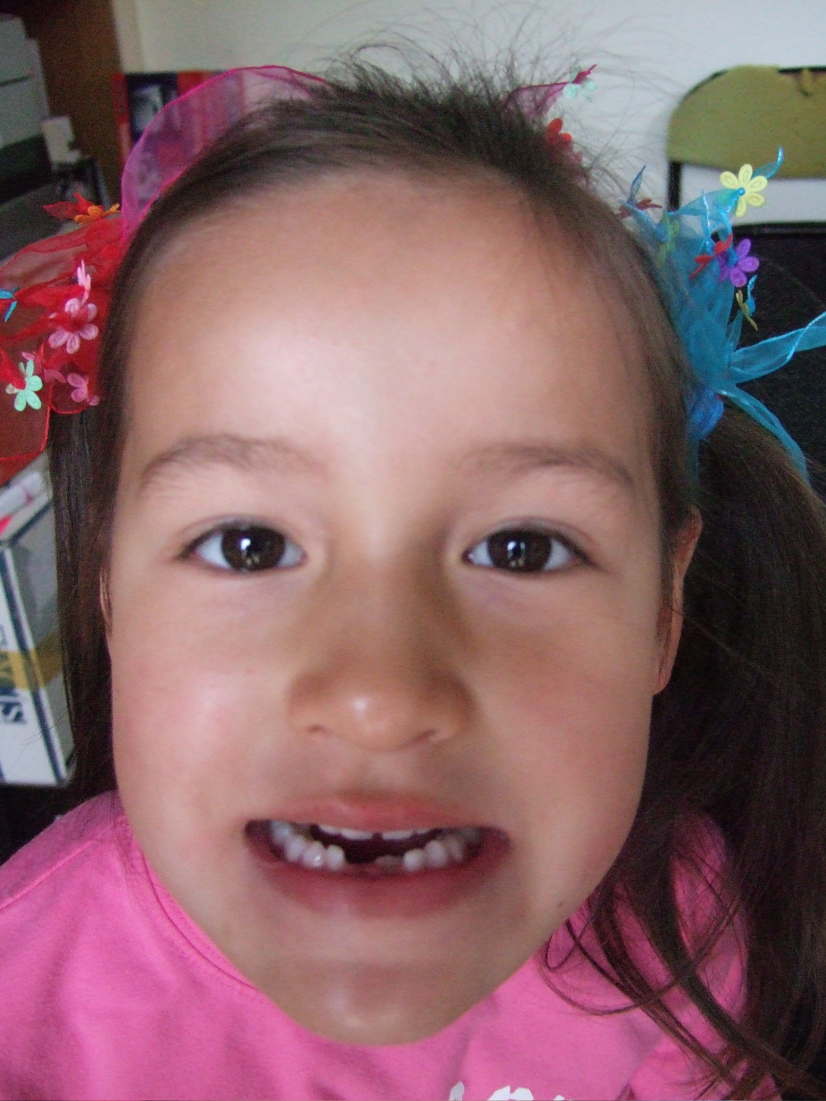 Atalia's missing front teeth